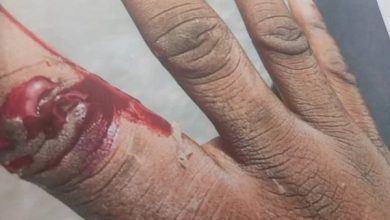 Driver jailed 9 months for biting Police Officer’s fingers